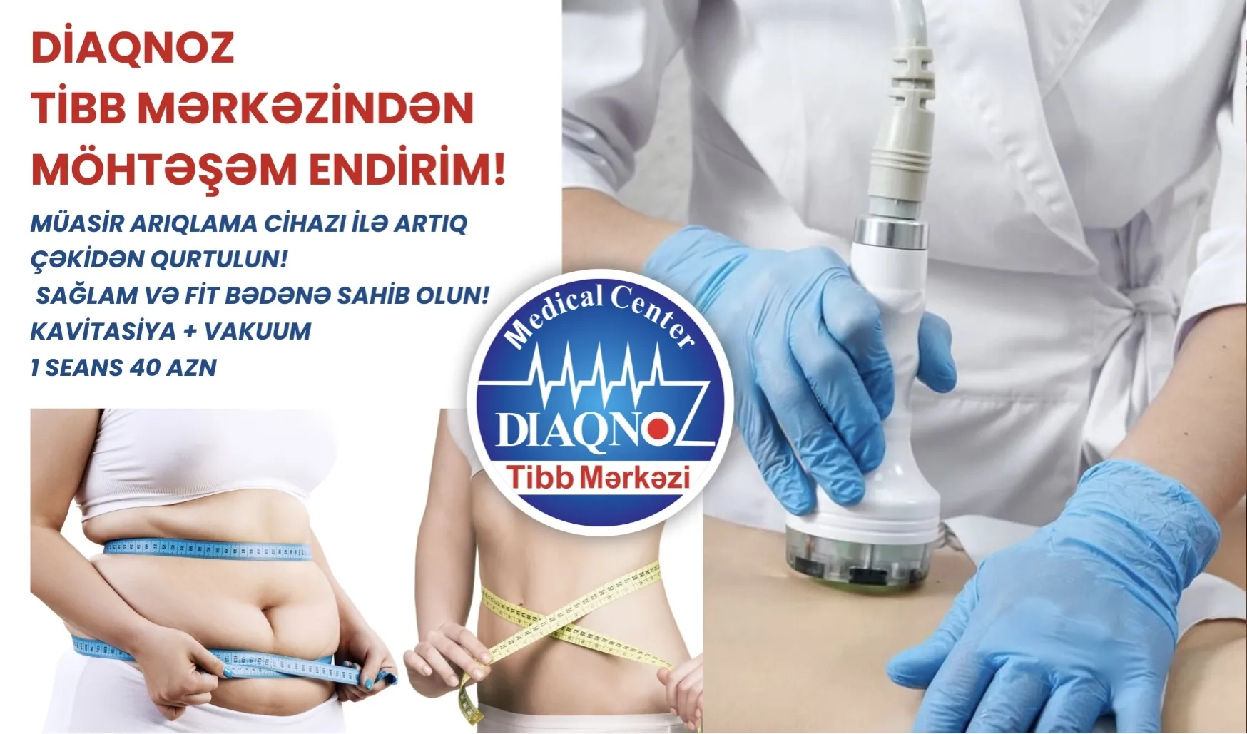 Diaqnoz Tibb Mərkəzindən möhtəşəm ENDİRİM!